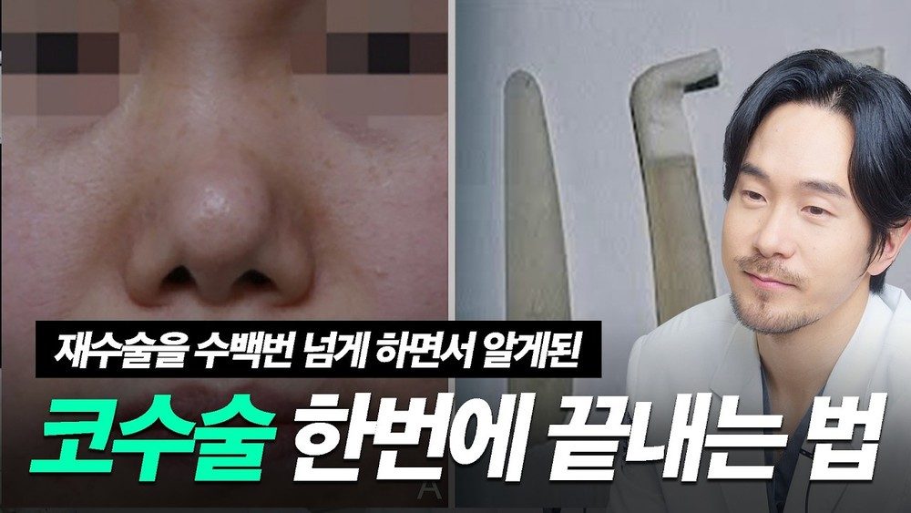 코성형 두번 안해도 되는 방법이 분명히 존재합니다!!