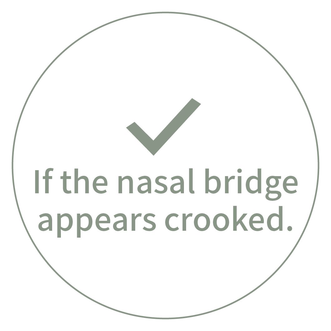 If the nasal bridge appears crooked.
