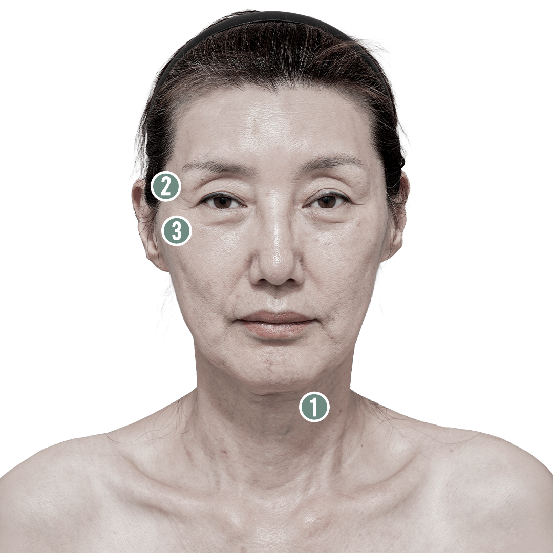 전후사진 7