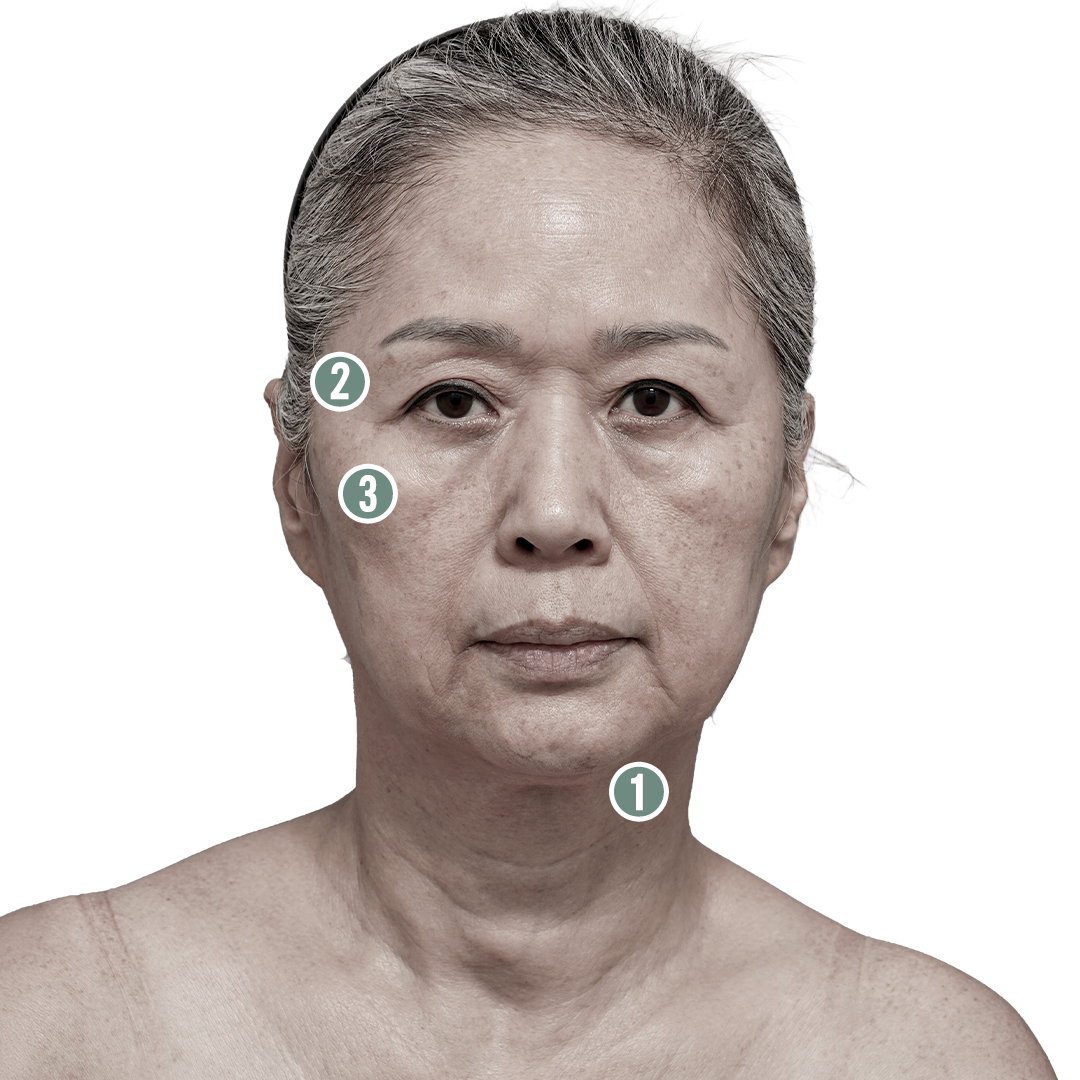 전후사진 5