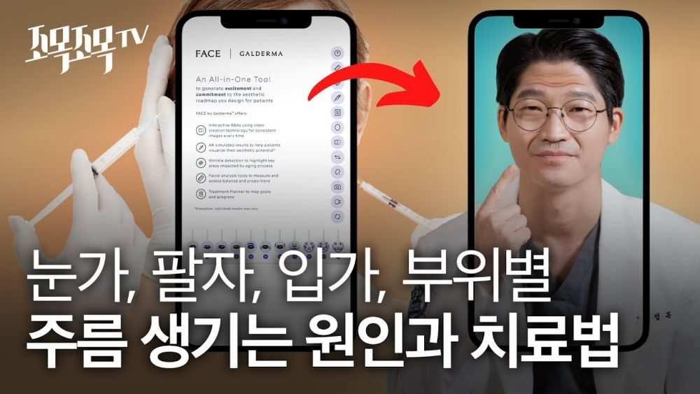 눈가, 팔자, 입가, 부위별 주름 생기는 원인과 치료법