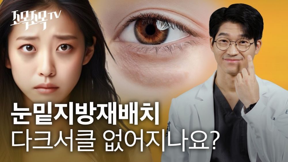 눈밑지방재배치 - 다크서클 없어지나요?