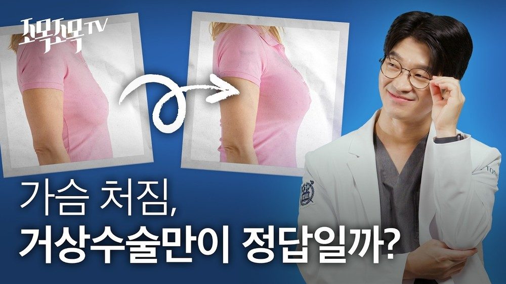 가슴이 처졌어요. 거상수술 없이예뻐질 수 있을까요?