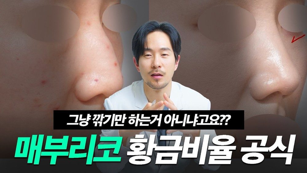 10분 투자로 평생 후회 안 할 매부리코 성형 황금 공식 공개