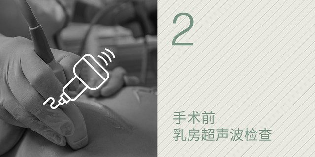 2 手术前 乳房超声波检查