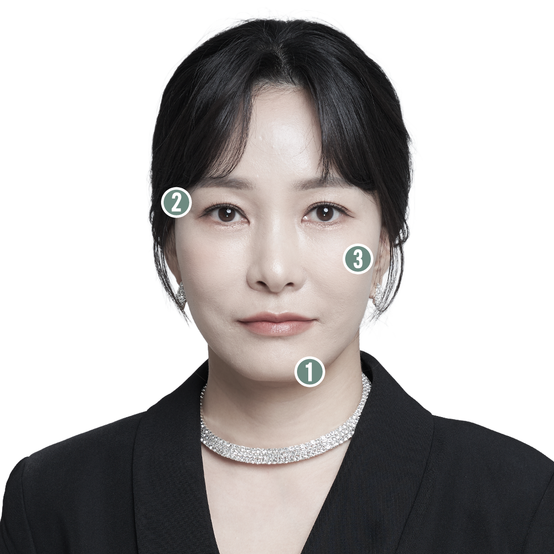 전후사진 2