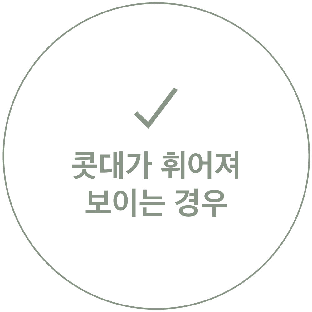 콧대가 휘어져 보이는 경우