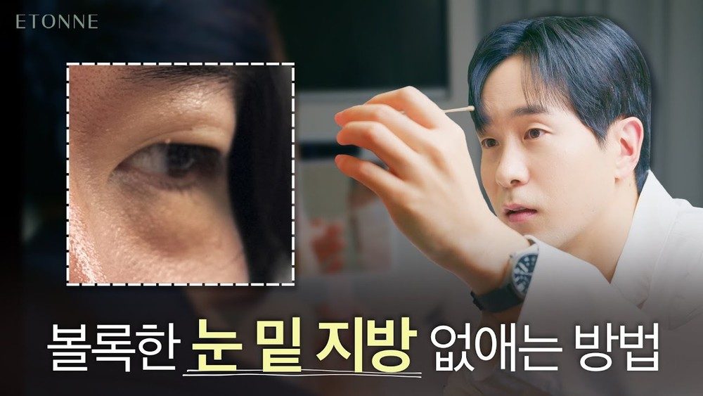 여러분은 이 환자가 몇살이라고 생각하십니까?? 30대가 늙어보이는 이유 l 눈밑지방