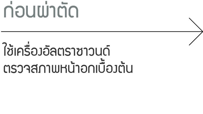 ก่อนผ่าตัด: ใช้เครื่องอัลตราซาวนด์ตรวจสภาพหน้าอกเบื้องต้น