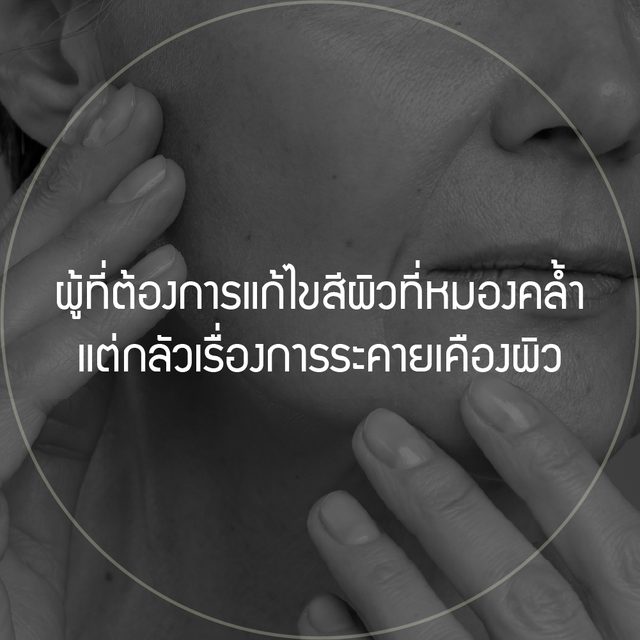 ภาพระยะใกล้แก้มและมือทรงกลม: ผู้ที่ต้องการแก้ไขสีผิวที่หมองคล้ำแต่กลัวเรื่องการระคายเคืองผิว