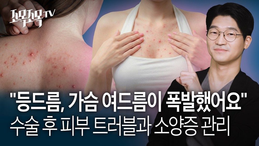 "등드름, 가슴 여드름이 폭발했어요" : 수술 후 피부 트러블과 소양증(가려움) 관리