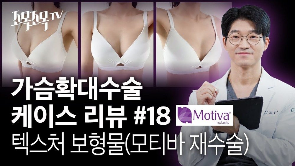 가슴 확대 수술 케이스 #18 - 텍스처 → 모티바 재수술