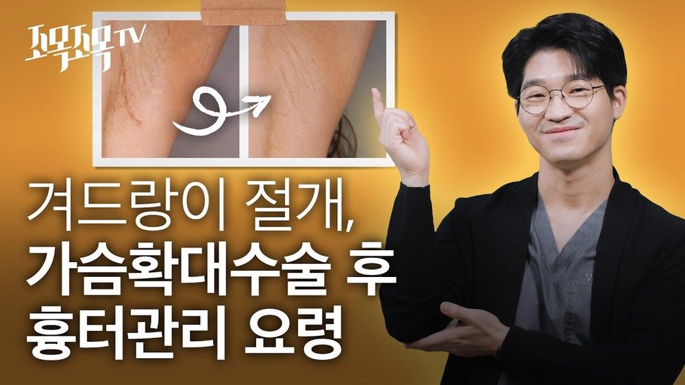겨드랑이 절개 가슴확대 수술 후 흉터 관리 요령