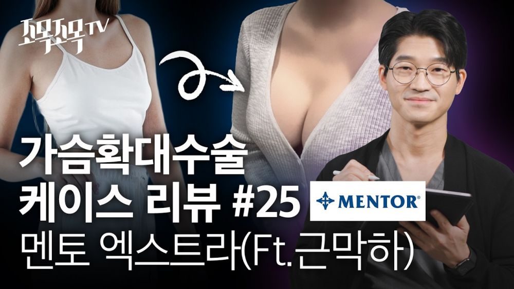 가슴확대수술 케이스 25 - 멘토엑스트라 근막하
