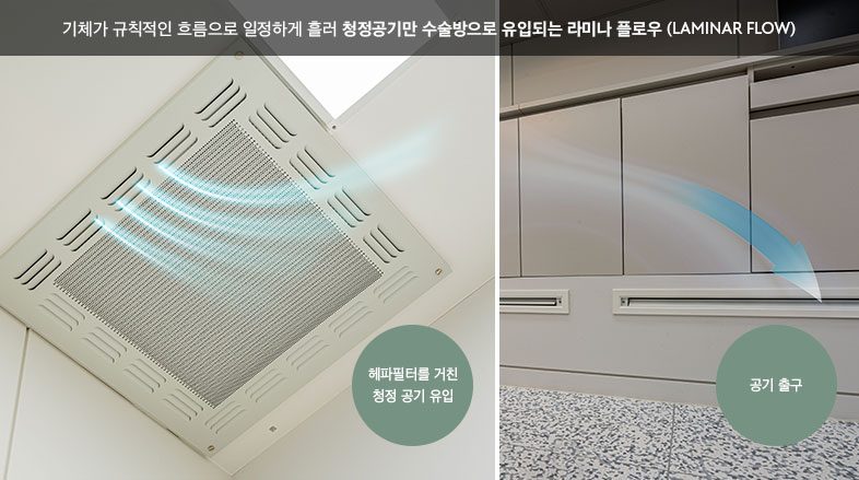 Laminar flow diagram with Korean captions: clean air, filtered through a HEPA filter, flows steadily into the operating room. Captions read "clean air intake through HEPA filter" and "air outlet"