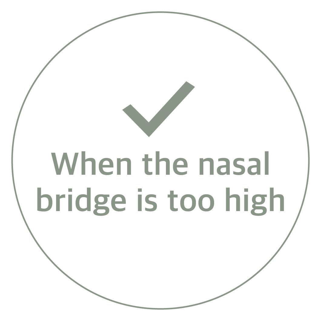 When the nasal bridge is too high