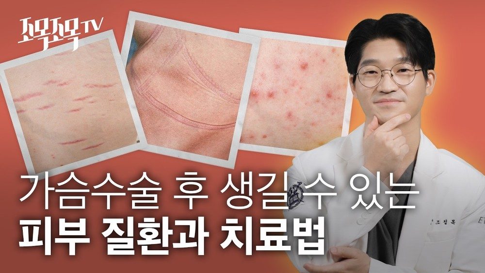 가슴확대 수술 후 생길 수 있는 피부 질환과 치료법