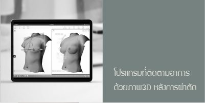 โปรแกรมที่ติดตามอาการด้วยภาพ 3D หลังการผ่าตัด
