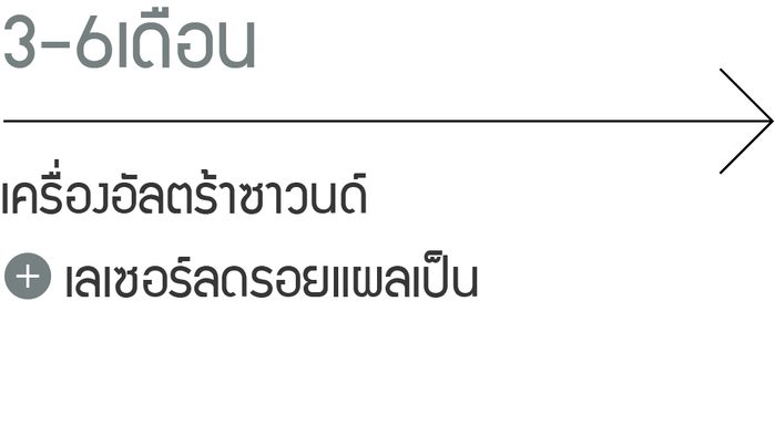 3-6 เดือน: เครื่องอัลตร้าซาวนด์, เลเซอร์ลดรอยแผลเป็น