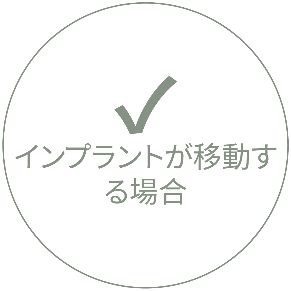 インプラントが動く場合