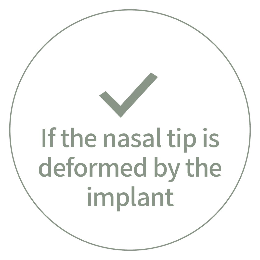 If the nasal tip is deformed by the implant