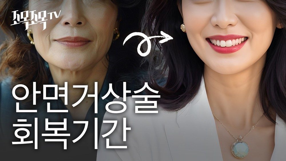 안면거상 수술은 회복이 오래 걸릴까?