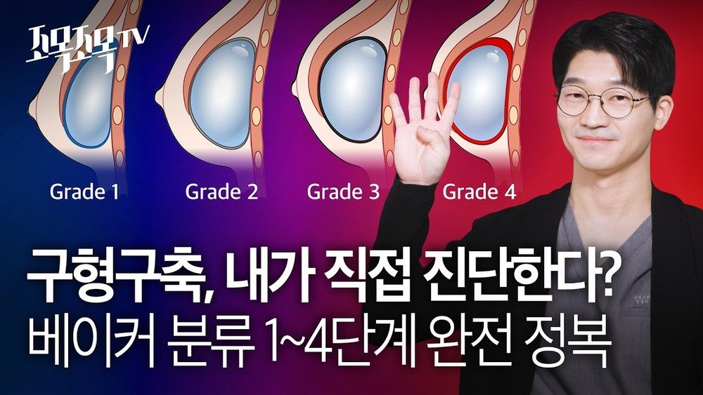 구형구축, 내가 직접 진단한다? '베이커 분류(Baker's Classification)' 1~4단계 완전 정복