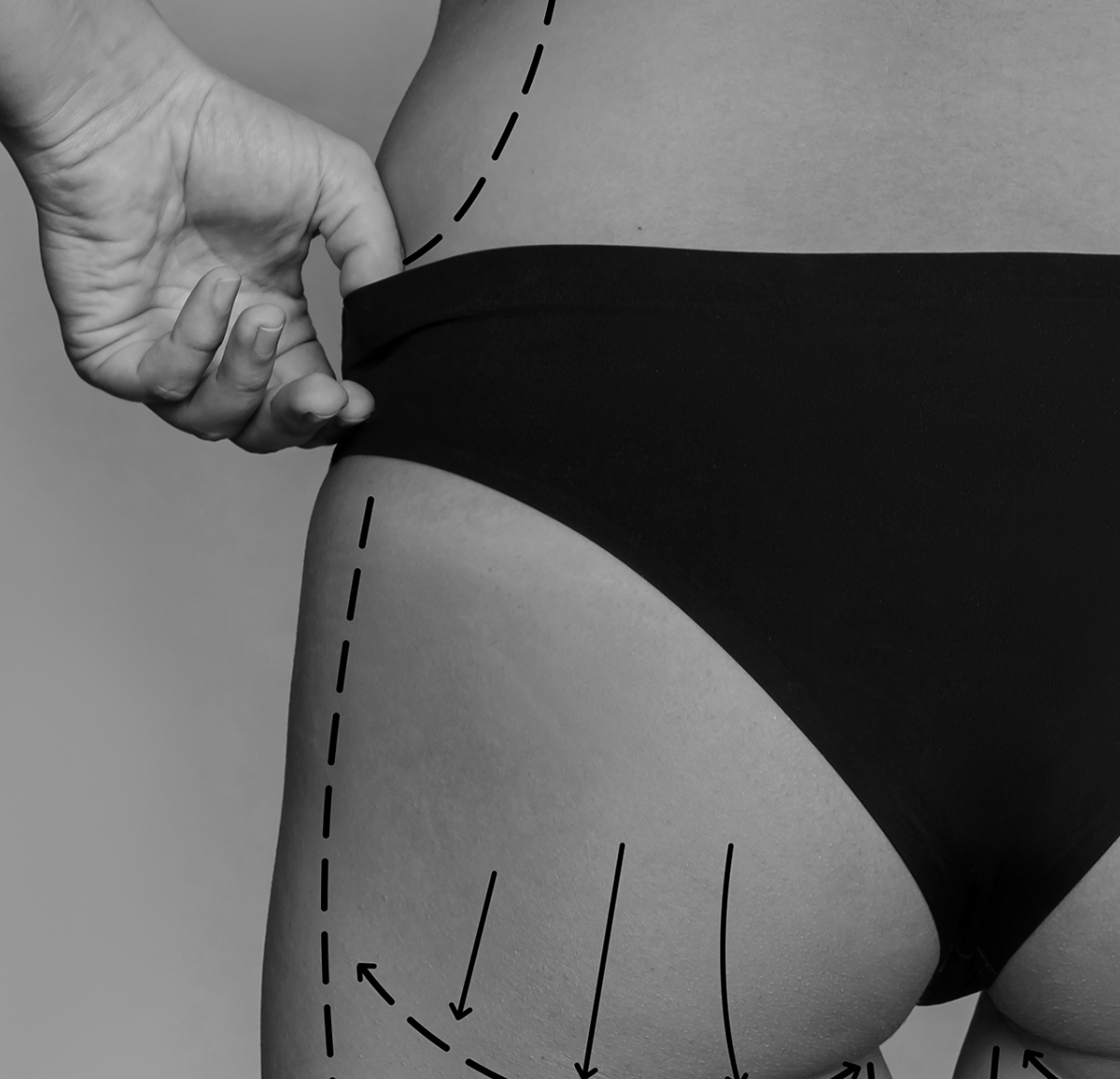 Black-and-white photo of a hand adjusting underwear with dashed guide lines marking the hip and thigh