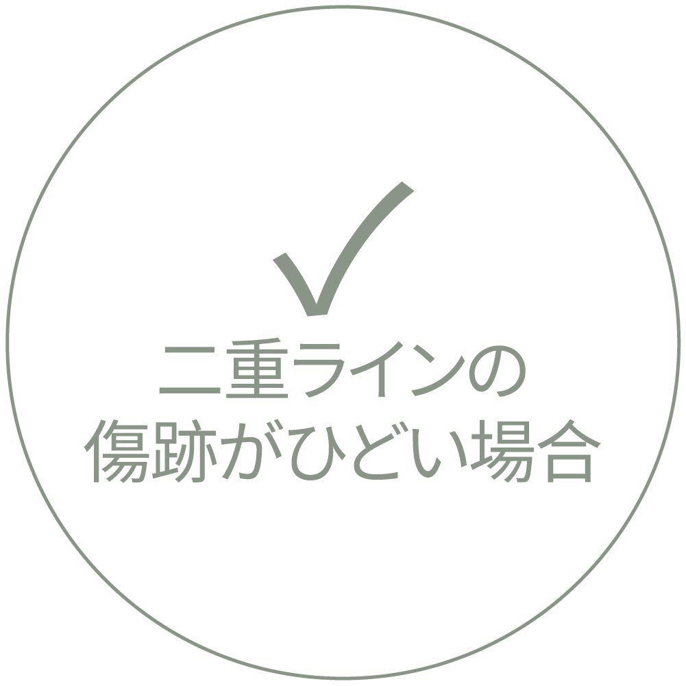 チェックマークと"二重ラインの傷跡がひどい場合"という文言が書かれたカード画像
