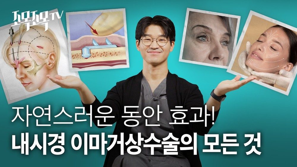 자연스러운 동안 효과, 내시경 이마 거상 수술의 모든 것