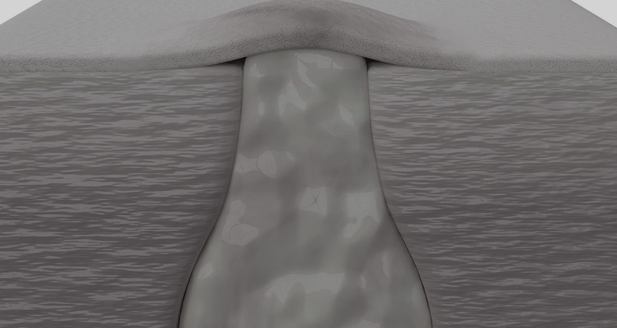 피부 모공 단면을 표현한 3D 그래픽 이미지
