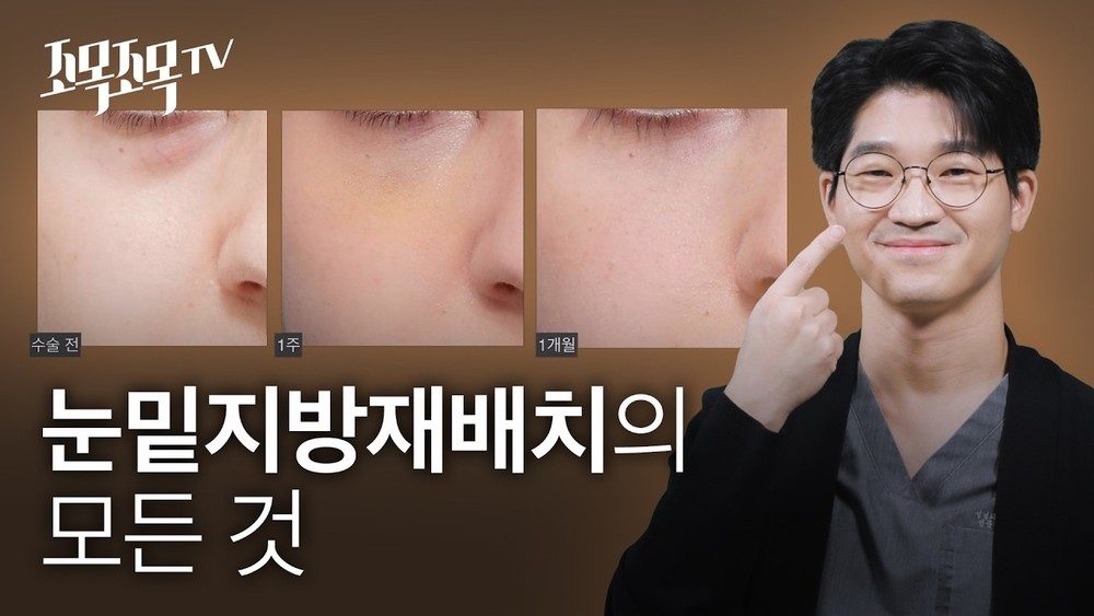 눈밑지방재배치의 모든 것