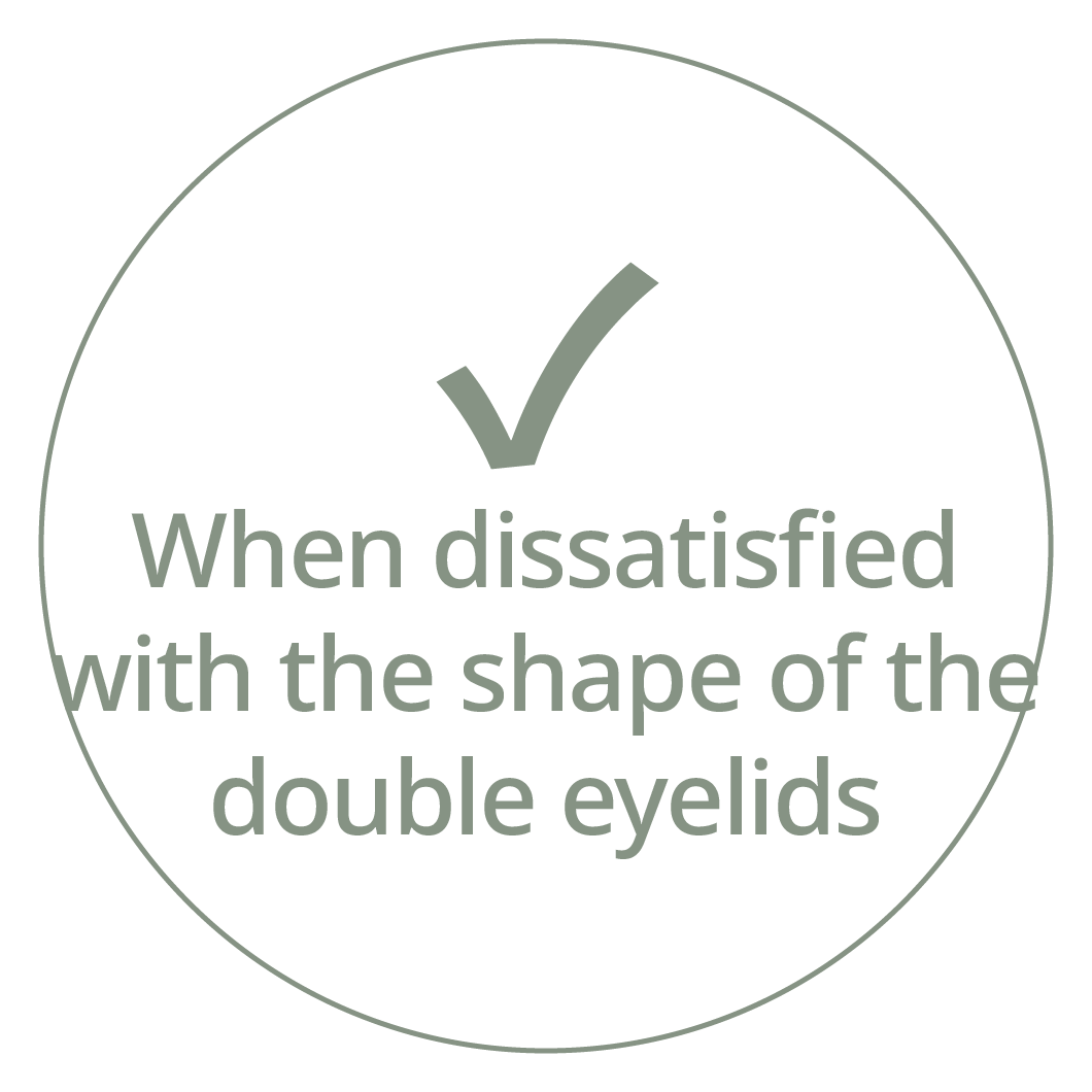 Card with a checkmark and the phrase "When dissatisfied with the shape of the double eyelids"