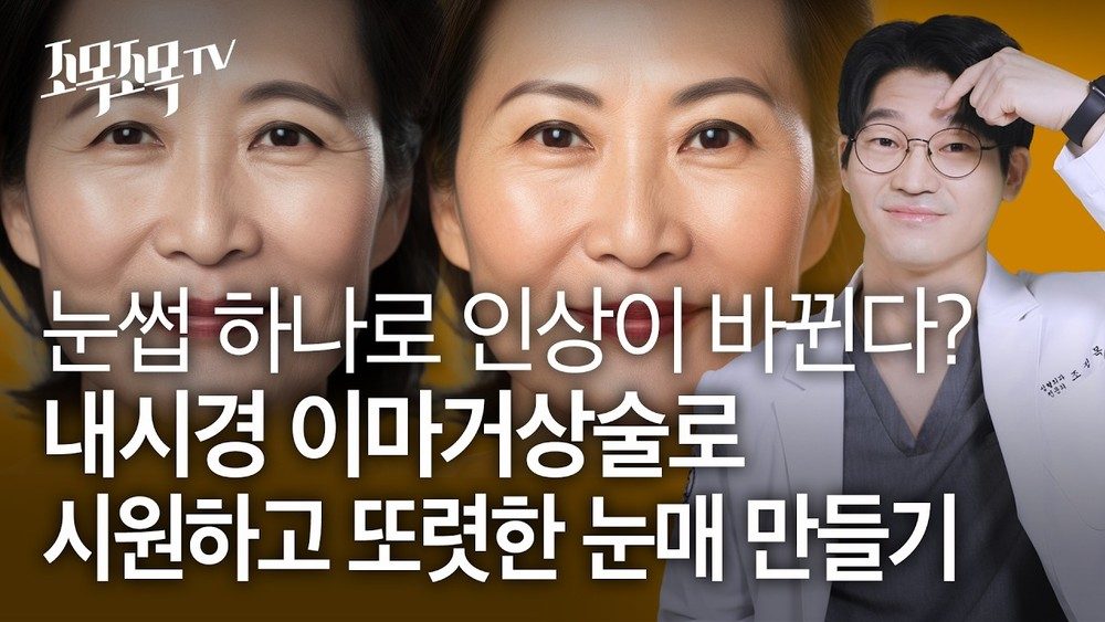 눈썹 하나로 인상이 바뀐다? 내시경 이마 거상술로 시원하고 또렷한 눈매 만들기
