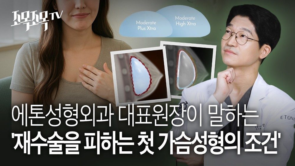 가슴확대수술 후 재수술 피하는 첫 가슴성형 필수 조건 3가지