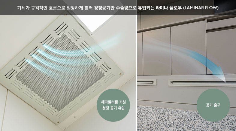 ภาพอธิบายลามินาร์โฟลว์ (LAMINAR FLOW) (ข้อความในภาพเป็นภาษาเกาหลี): อากาศไหลเป็นระเบียบสม่ำเสมอ มีเพียงอากาศสะอาดที่ไหลเข้าห้องผ่าตัด อากาศสะอาดผ่านแผ่นกรอง HEPA เข้ามา และช่องระบายอากาศออก