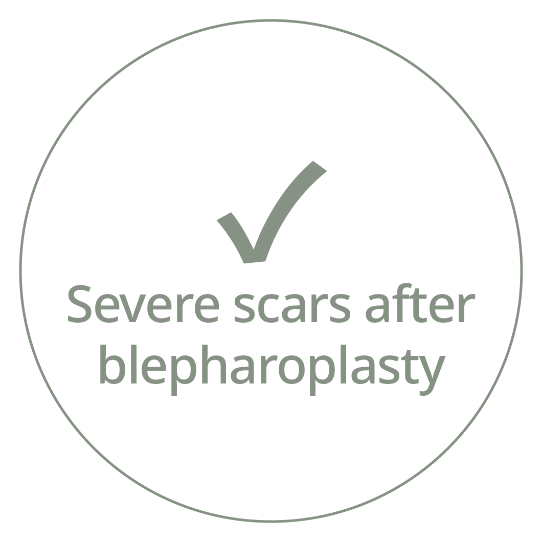 Card with a checkmark and the phrase "Severe scars after blepharoplasty"