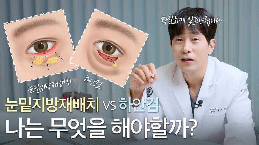 5분만에 고민해결!! 눈밑지방재배치 vs 하안검