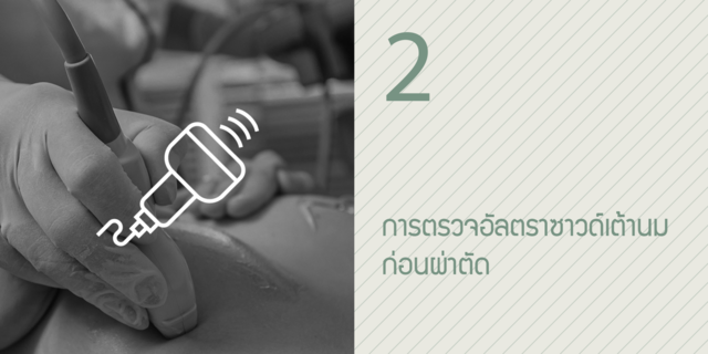 2, การตรวจอัลตราซาวด์เต้านมก่อนผ่าตัด