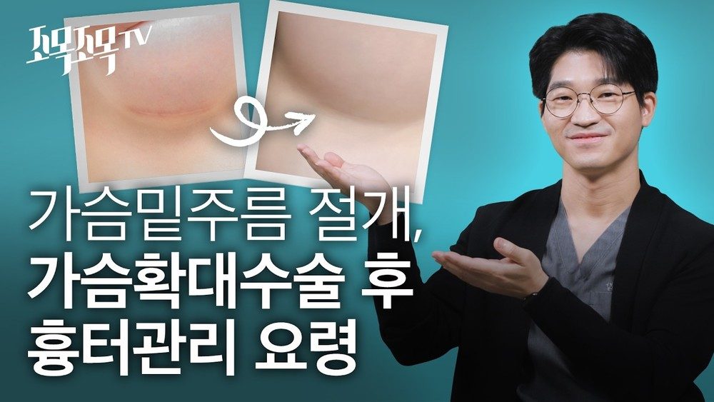 밑주름 절개 가슴확대 수술 후 흉터 관리 요령