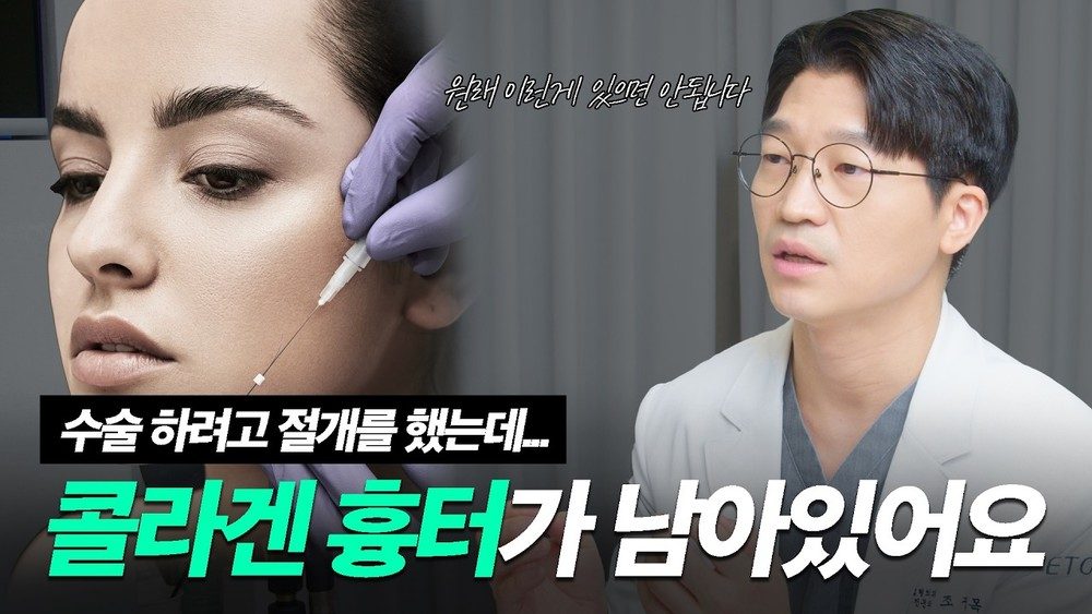 수술하다 알게 된 실리프팅 시술도 실력이 중요한 이유