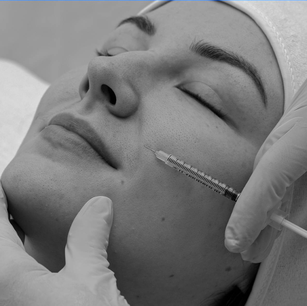 Black-and-white close-up of a woman receiving a filler injection