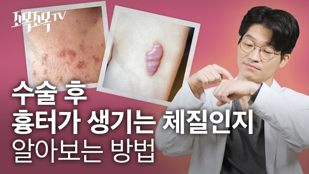 수술 후 흉터가 생기는 체질인지 알아보는 방법