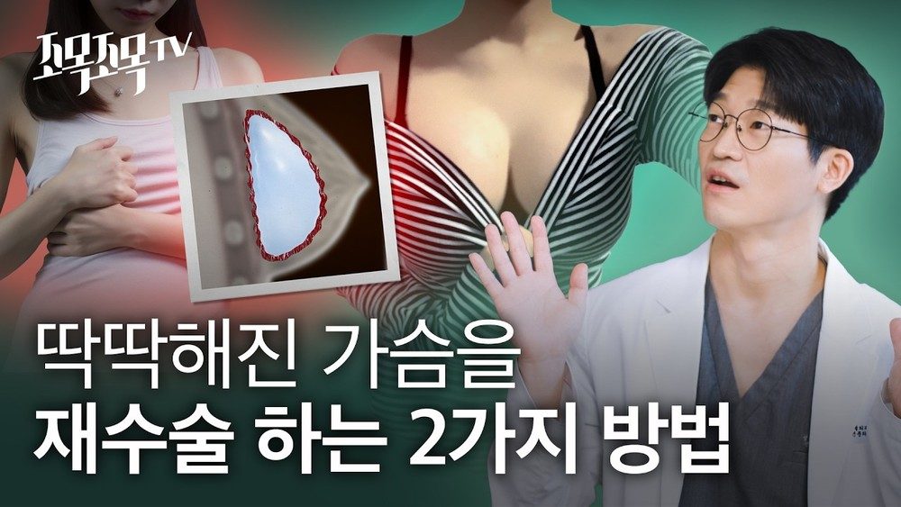 딱딱해진 가슴을 재수술 하는 두가지 방법