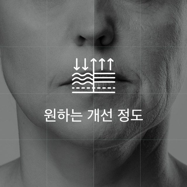 원하는 개선 정도