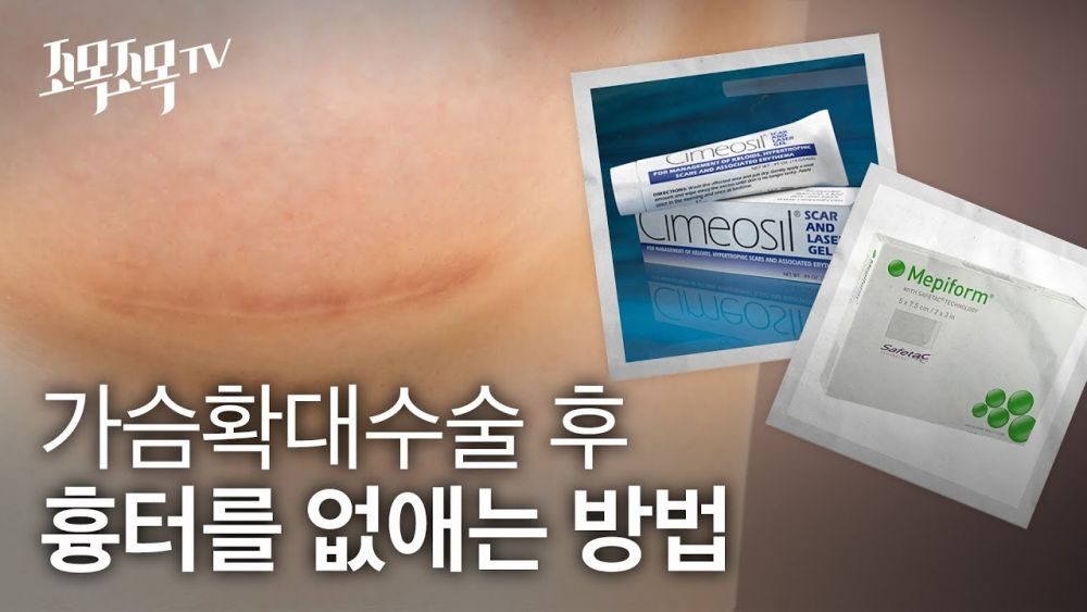 가슴확대 수술 후 흉터를 없애는 방법