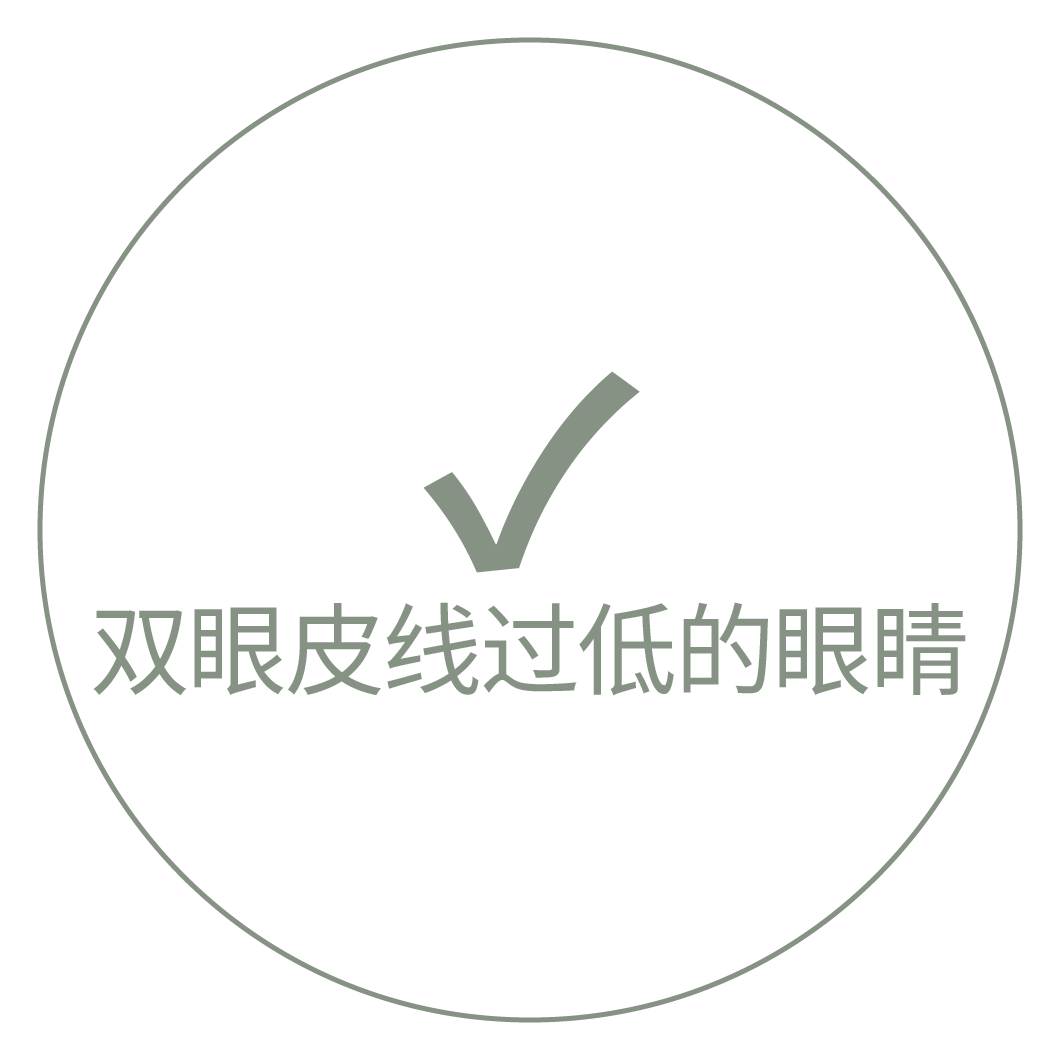 带对勾标记和"双眼皮线过低的眼睛"文字的卡片图像