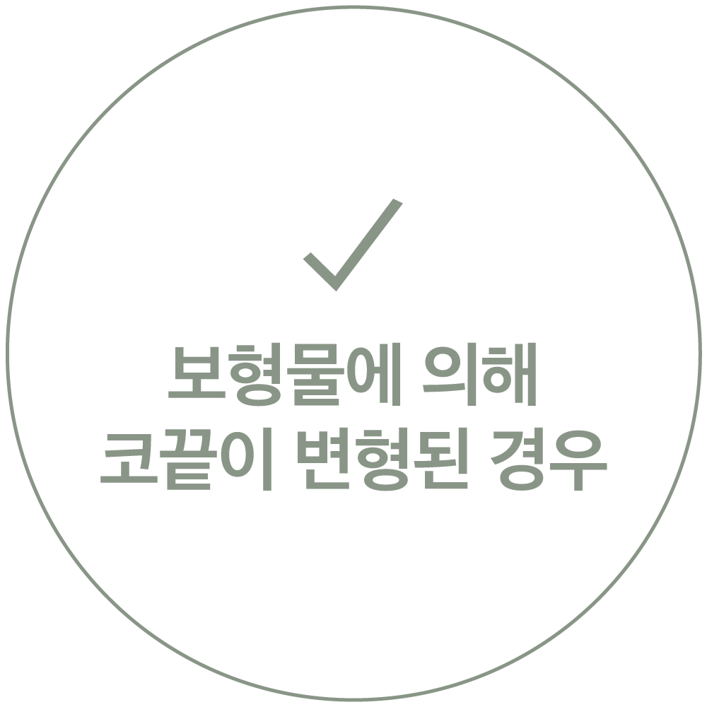 보형물에 의해 코끝이 변형된 경우