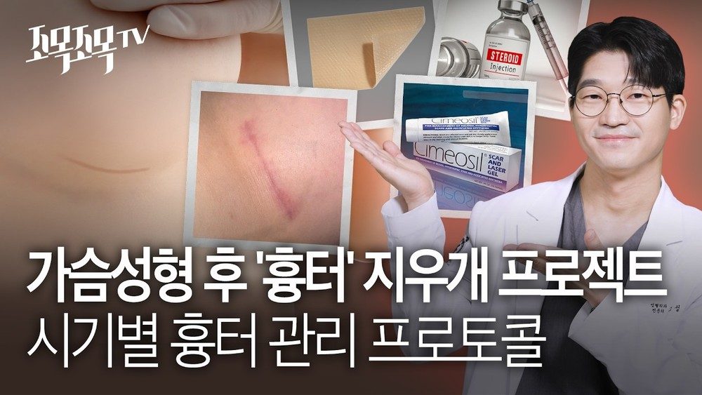 가슴 성형 후 '흉터' 지우개 프로젝트: 시기별 흉터 관리 프로토콜 (레이저, 주사, 연고)