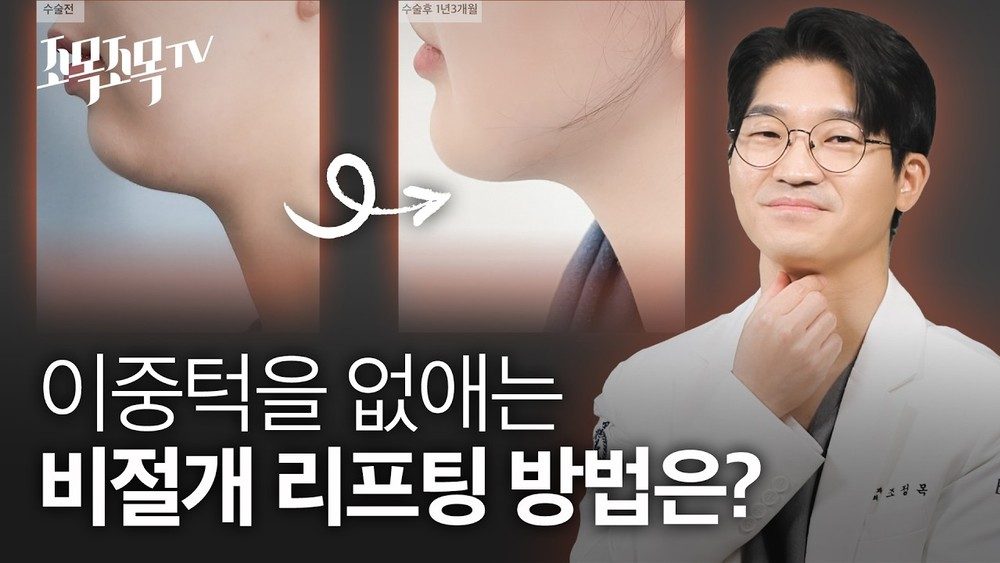 이중턱을 없애는 비절개 리프팅 방법은?